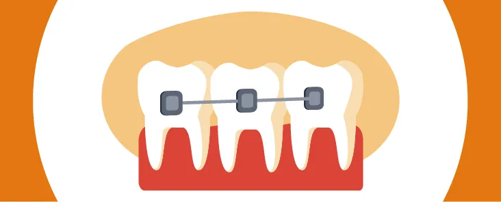 MDS in Canada: Know All About Masters in Dentistry in Canada for Indian Students Image