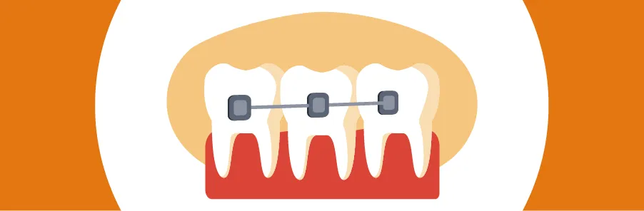 MDS in Canada: Know All About Masters in Dentistry in Canada for Indian Students Image